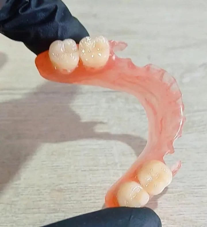Prótesis flexible